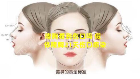 隆胸看到伤口吗 假体隆胸21天伤口感染